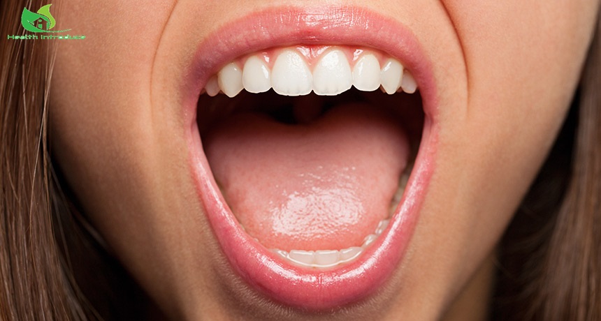 Roof of Mouth is Yellow - Causes, Symptoms, Treatment