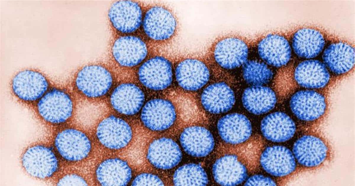 How Can Rotavirus Infection Be Treated?