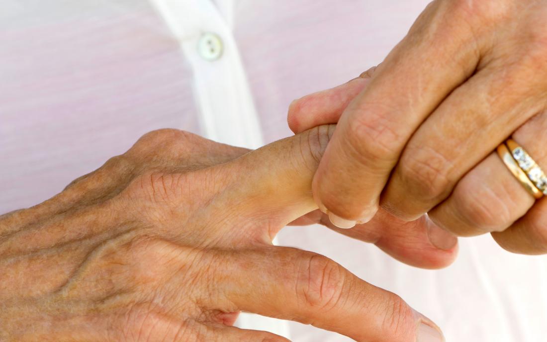 Finger Twitching - Causes, Symptoms, Prevention, Treatment
